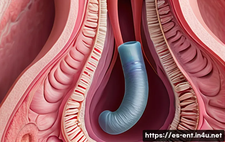 성대 폴립과 암 구별법 - A detailed medical illustration of human vocal cords under laryngoscopy, showing a smooth, well-defi...